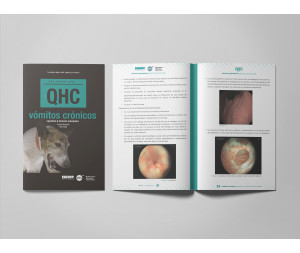 Revista QHC vómitos crónicos